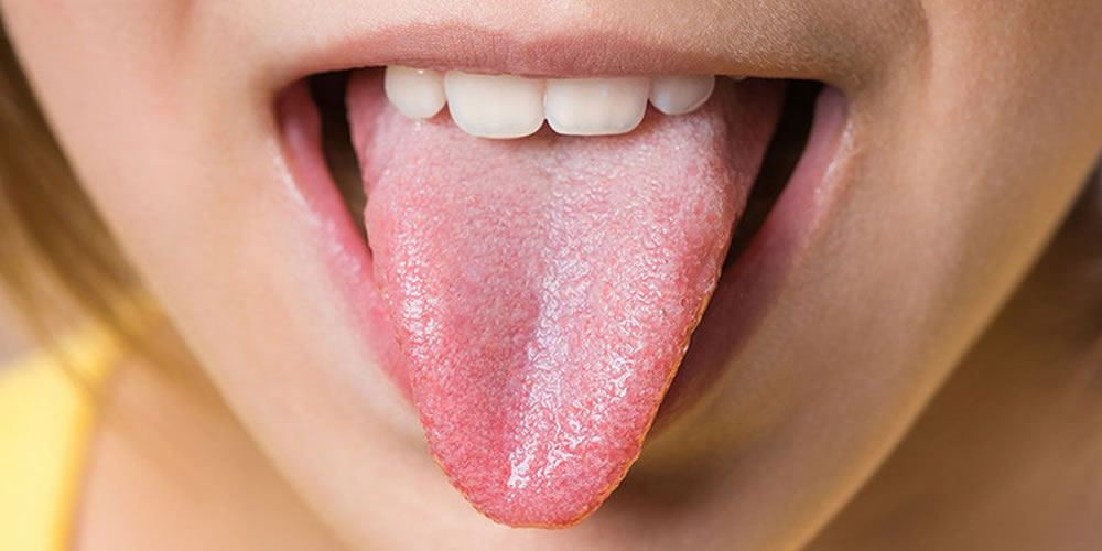 舌が白くなった際に考えられる病気