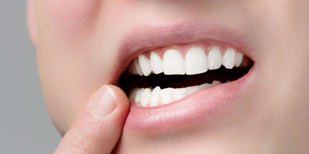 歯茎の白いできものの原因と治療法について
