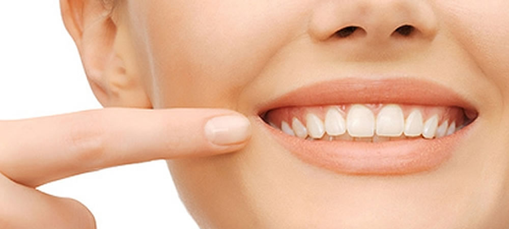 歯を抜かない矯正治療のメリット・リスクについて